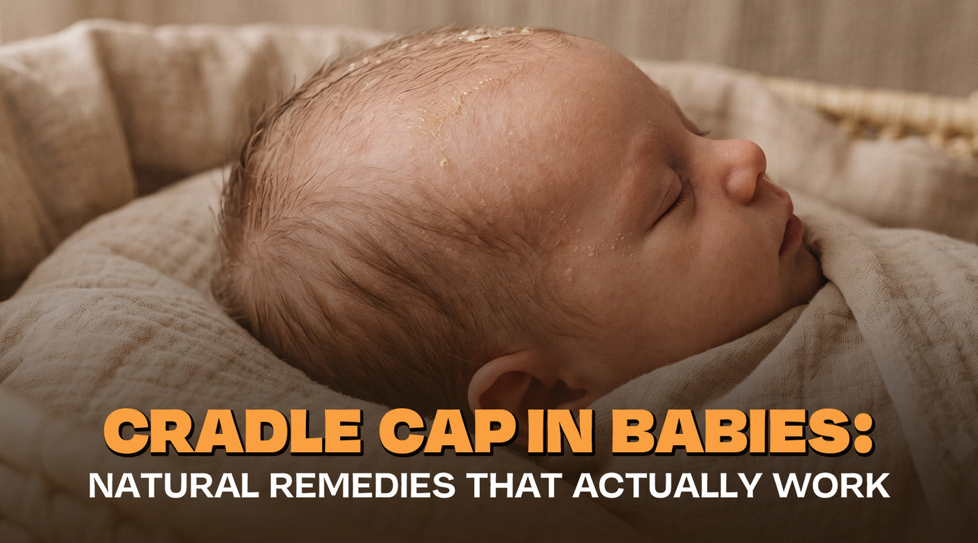 Cradle Cap in Babies: Natural Remedies That Actually Work