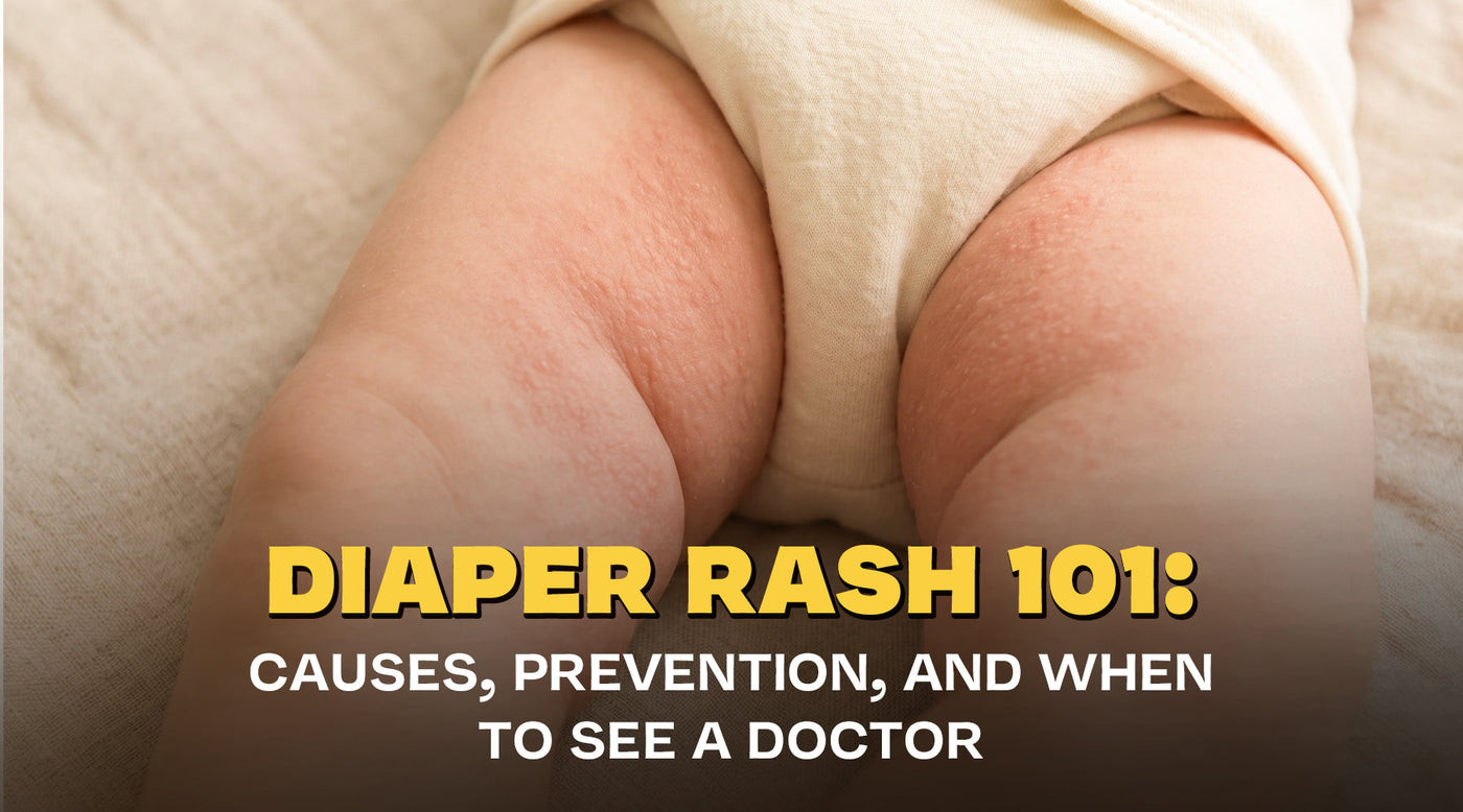 Diaper Rash 101: Causes, Prevention, and When to See a Doctor