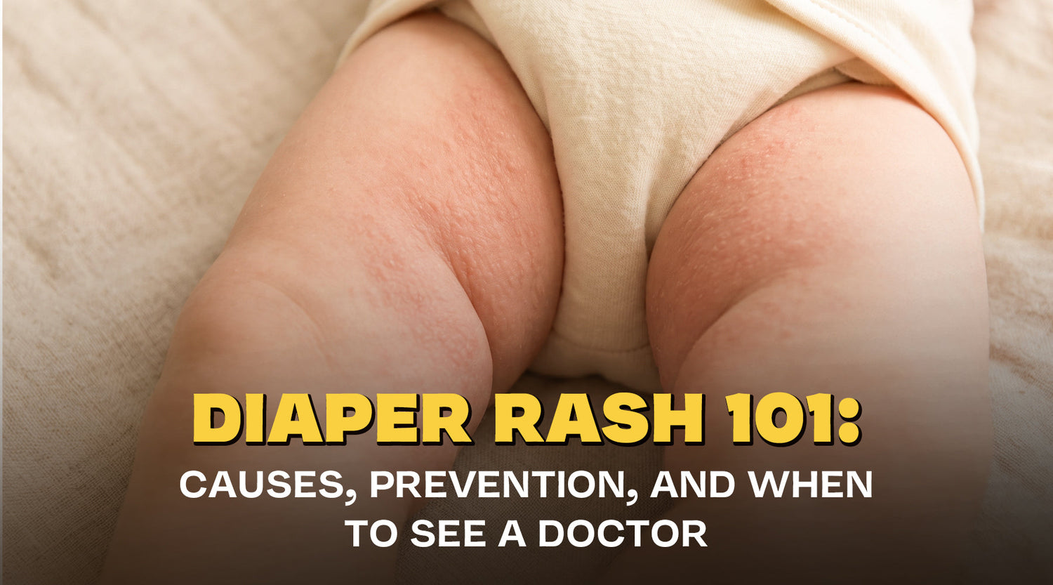 Diaper Rash 101