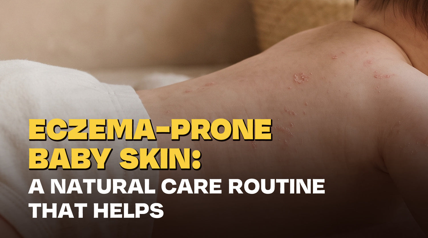 Eczema-Prone Baby Skin