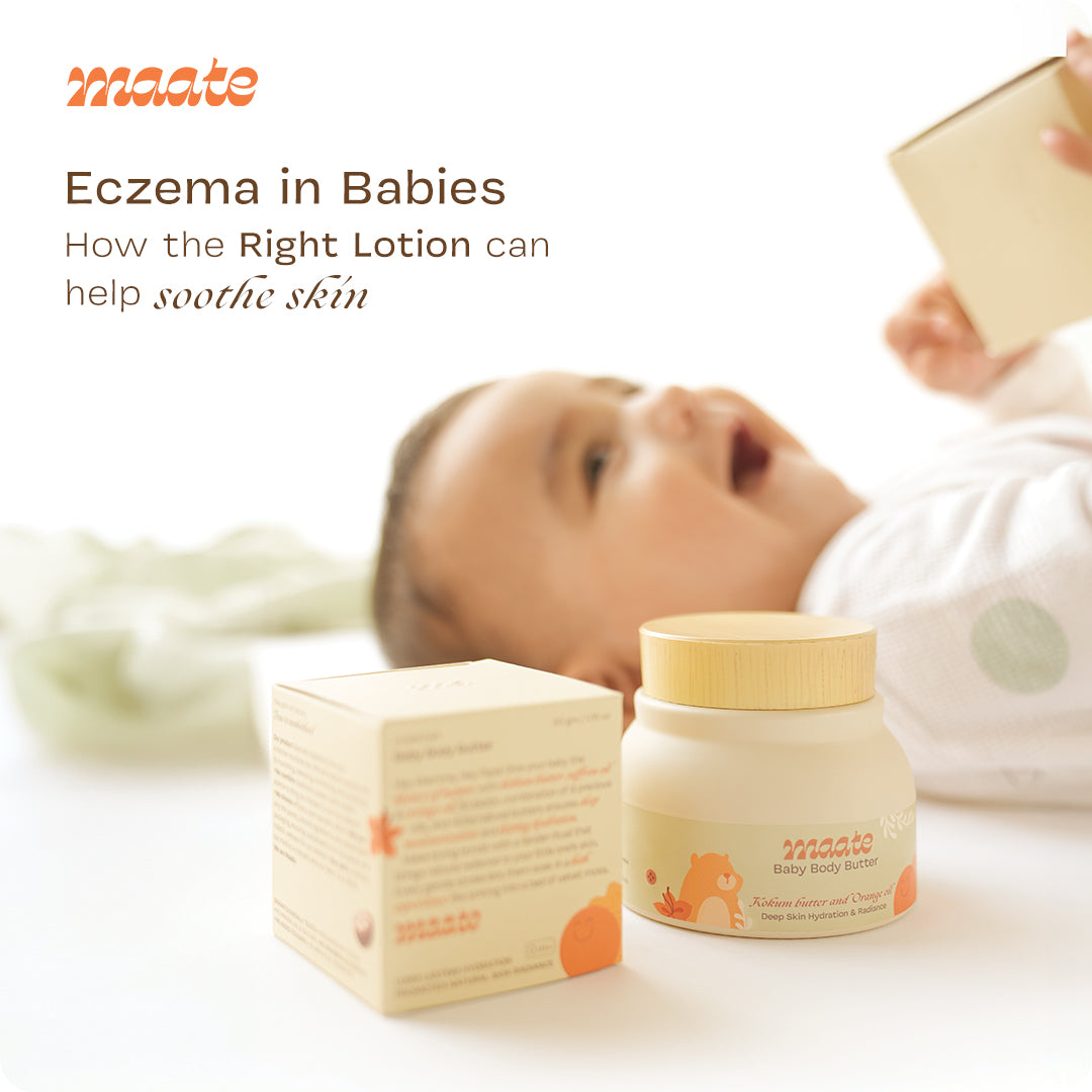 Eczema in Babies: How the Right Lotion Can Help Soothe Skin