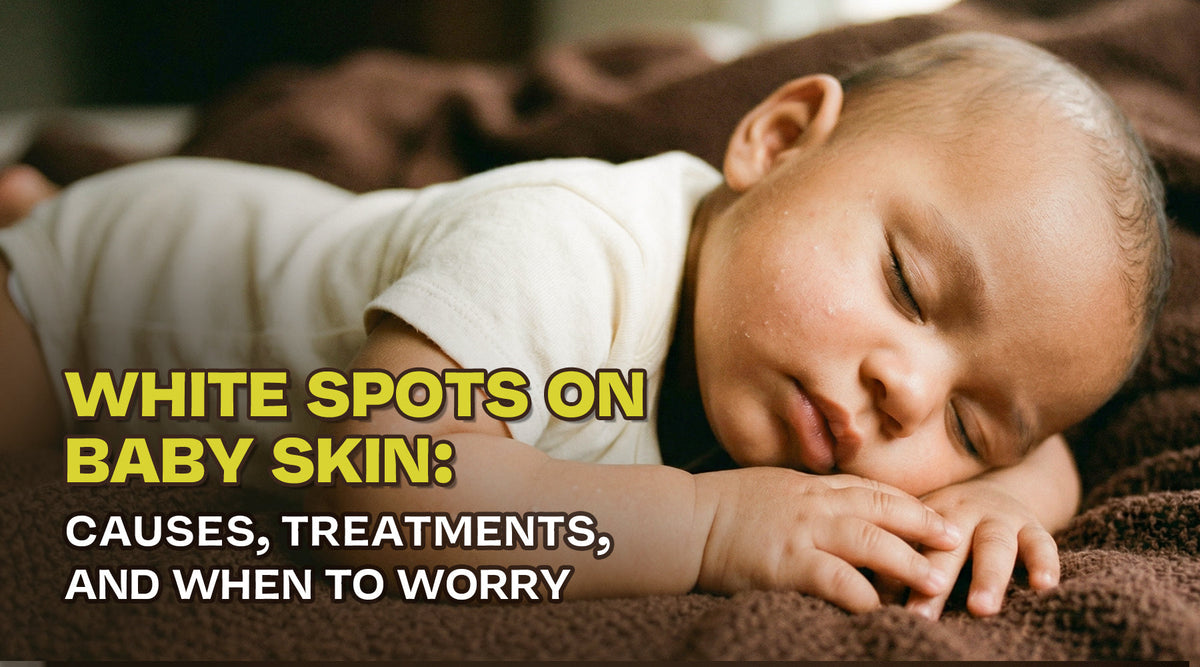 white spots on baby skin